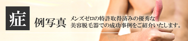 症例写真バナー